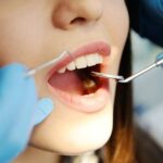 Close up of dental checkup